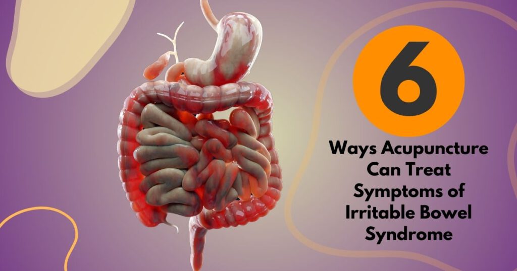 Illustration of the digestive system affected by Irritable Bowel Syndrome, showing inflammation and common IBS symptoms like bloating and abdominal pain. Acupuncture for Irritable Bowel Syndrome can help reduce these symptoms by promoting balance in the digestive system and relieving discomfort associated with IBS